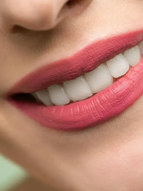 Sonrisa perfecta - Clínica Dental